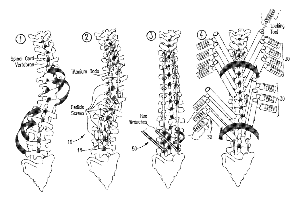 Federal Circuit Finds Its Spine: Rejecting "Hyper-Technical" Gatekeeping