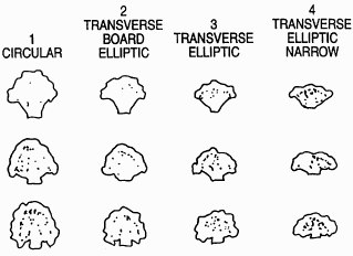 broccoli_patent